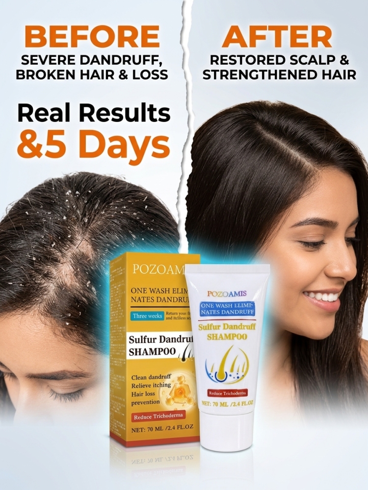 Hair Care Dandruff - Kräuter-Shampoo gegen Schuppen, hilft bei der