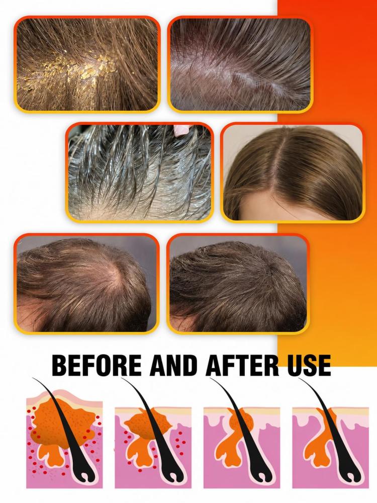 Kräuter-Shampoo gegen Schuppen – Hair Care Dandruff Bewertung und Preis