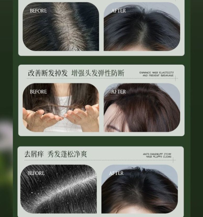 AJAK Usman Gras-Shampoo zur Öl – Hair Care Dandruff Bewertung und Preis
