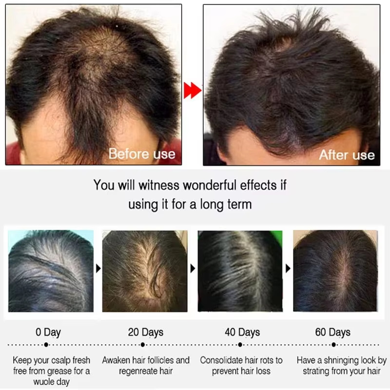Schnelles Ingwer-Haarwuchsspra – Hair Care Products Bewertung und Preis